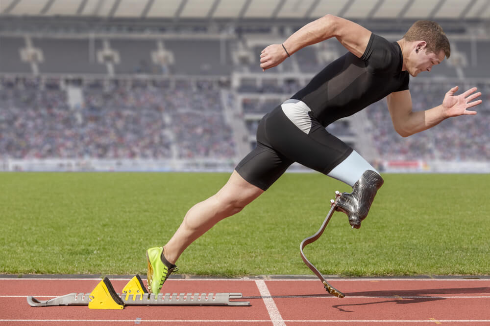 What are prosthetic limbs made of